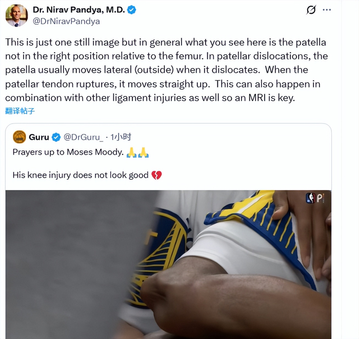 勇士球员穆迪左腿严重伤病恐影响季后赛前景